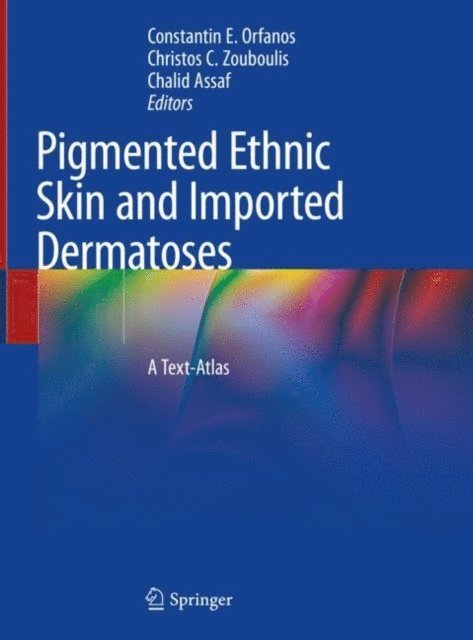 Chalid Assaf, Christos C. Zouboulis, Constantin E. Orfanos - Pigmented Ethnic Skin and Imported Dermatoses, E-bok