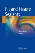 Pit and Fissure Sealants