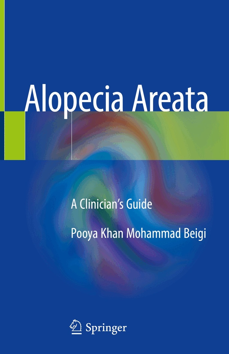 Pooya Khan Mohammad Beigi - Alopecia Areata, Inbunden. Tillgänglighet: Lägg i varukorg