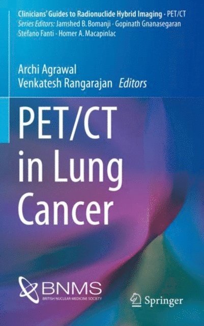 Venkatesh Rangarajan, Archi Agrawal - PET/CT in Lung Cancer, E-bok