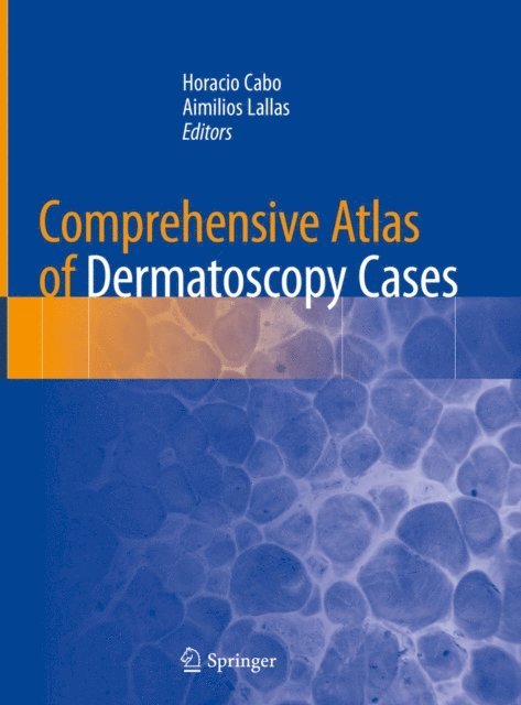 Aimilios Lallas, Horacio Cabo - Comprehensive Atlas of Dermatoscopy Cases, E-bok
