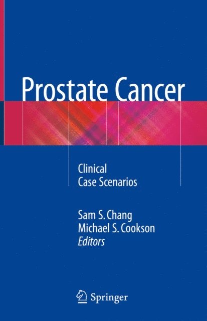 Michael S. Cookson, Sam S. Chang - Prostate Cancer, E-bok
