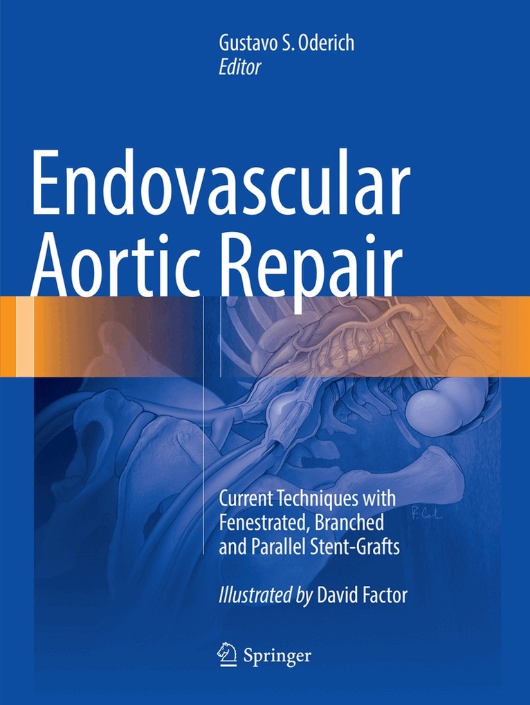 Gustavo S. Oderich - Endovascular Aortic Repair, Häftad. Tillgänglighet: Lägg i varukorg