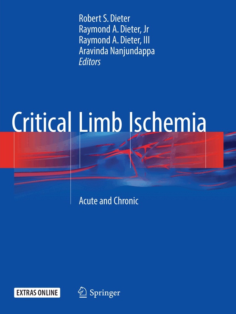 Robert S. Dieter, Raymond A. Dieter, Jr, Raymond A. Dieter, III, Aravinda Nanjundappa - Critical Limb Ischemia, Häftad