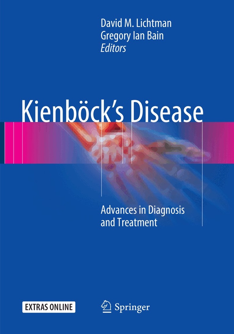 David M. Lichtman, Gregory Ian Bain - Kienböck’s Disease, Häftad. Tillgänglighet: Lägg i varukorg