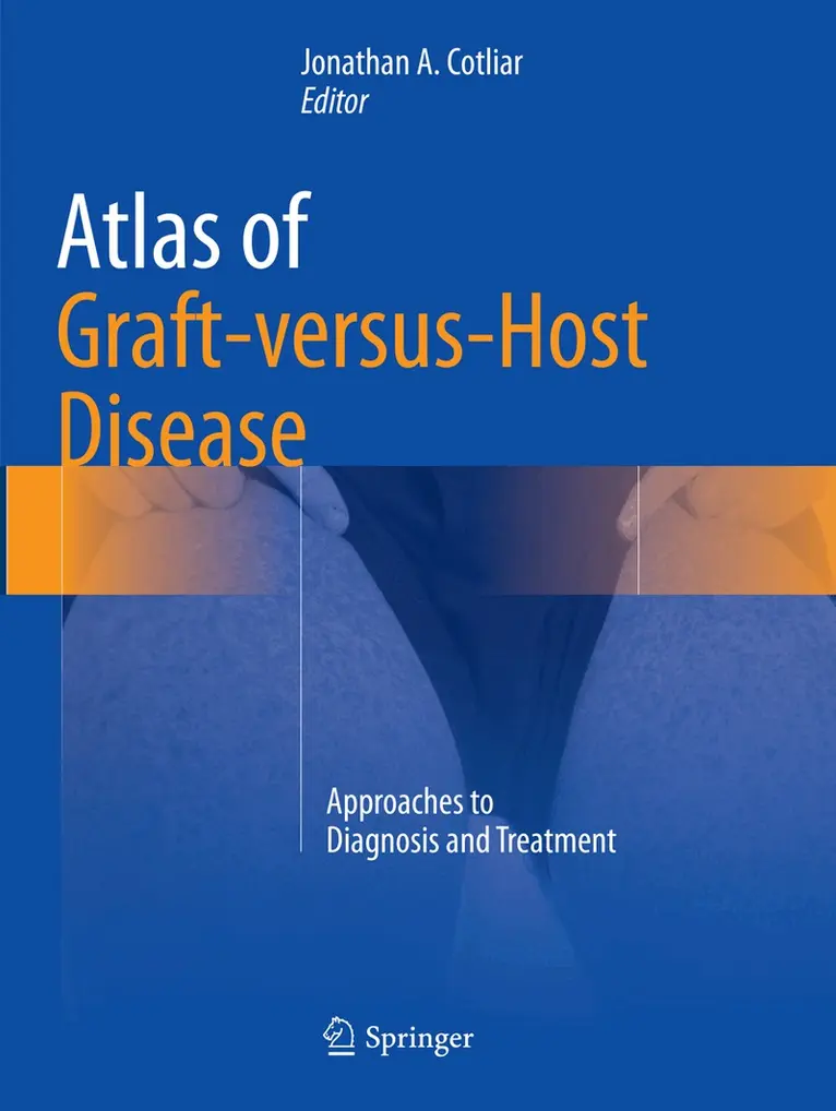 Jonathan A. Cotliar - Atlas of Graft-versus-Host Disease, Häftad. Tillgänglighet: Lägg i varukorg