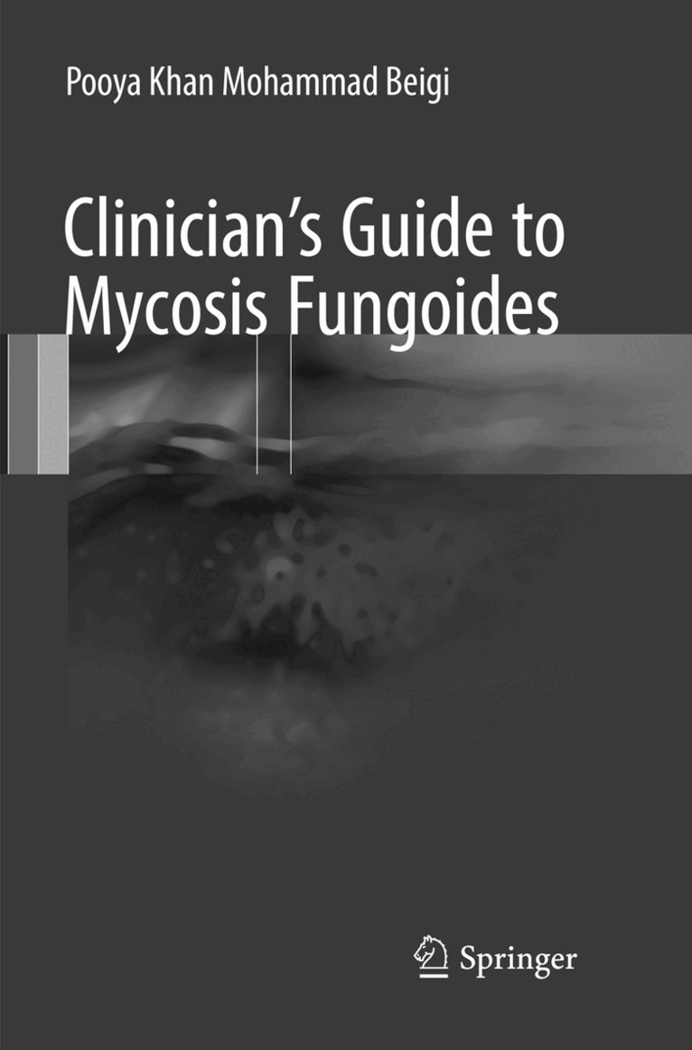 Pooya Khan Mohammad Beigi - Clinician's Guide to Mycosis Fungoides, Häftad. Tillgänglighet: Lägg i varukorg