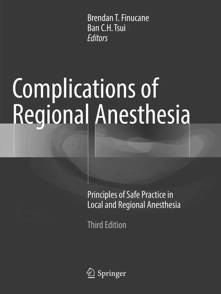 Brendan T. Finucane, Ban C.H. Tsui - Complications of Regional Anesthesia, Häftad. Tillgänglighet: Lägg i varukorg