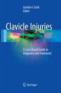 Clavicle Injuries