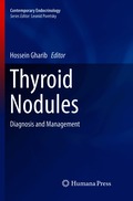 Thyroid Nodules