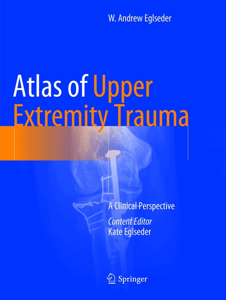 W. Andrew Eglseder - Atlas of Upper Extremity Trauma, Häftad. Tillgänglighet: Lägg i varukorg