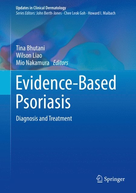 Mio Nakamura, Wilson Liao, Tina Bhutani - Evidence-Based Psoriasis, E-bok