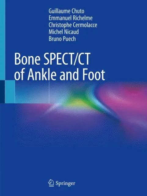 Bruno Puech, Michel Nicaud, Christophe Cermolacce, Emmanuel Richelme, Guillaume Chuto - Bone SPECT/CT of Ankle and Foot, E-bok. Tillgänglighet: Lägg i varukorg