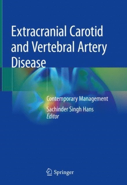Sachinder Singh Hans - Extracranial Carotid and Vertebral Artery Disease, E-bok