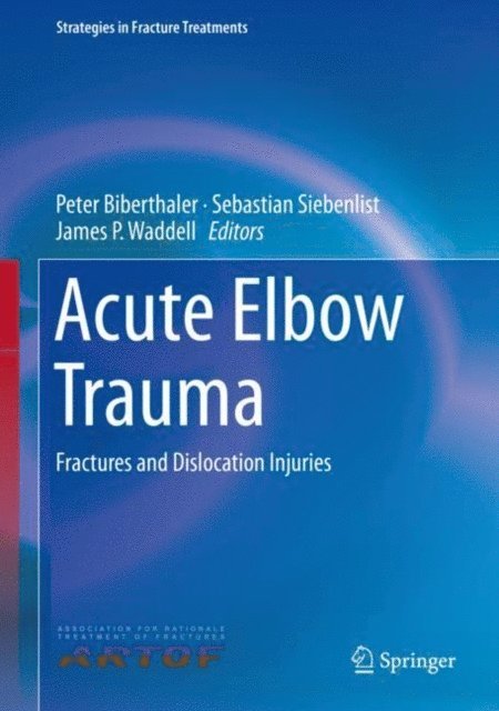 James P. Waddell, Sebastian Siebenlist, Peter Biberthaler - Acute Elbow Trauma, E-bok