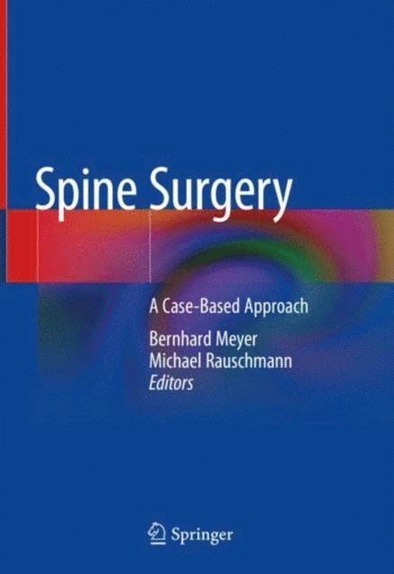 Michael Rauschmann, Bernhard Meyer - Spine Surgery, E-bok