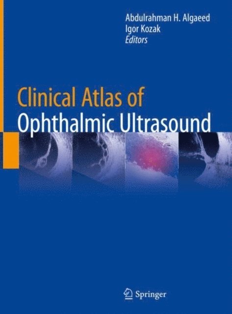 Igor Kozak, Abdulrahman H. Algaeed - Clinical Atlas of Ophthalmic Ultrasound, E-bok