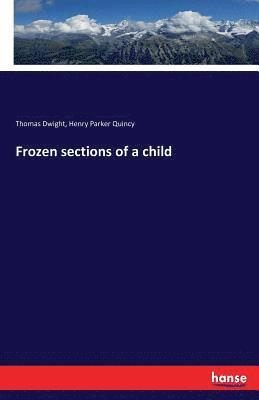 Thomas Dwight, Henry Parker Quincy - Frozen sections of a child, Häftad. Tillgänglighet: Lägg i varukorg