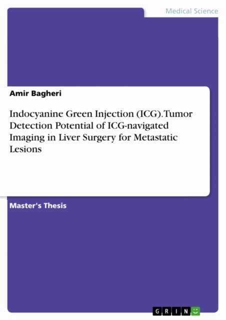 Amir Bagheri - Indocyanine Green Injection (ICG). Tumor Detection Potential of ICG-navigated Imaging in Liver Surgery for Metastatic Lesions, E-bok