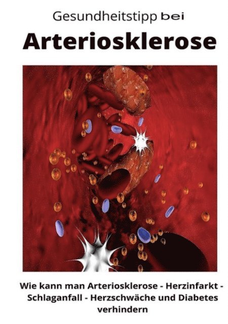 Maximilian Loidl - Gesundheitstipp bei Arteriosklerose, E-bok. Tillgänglighet: Lägg i varukorg