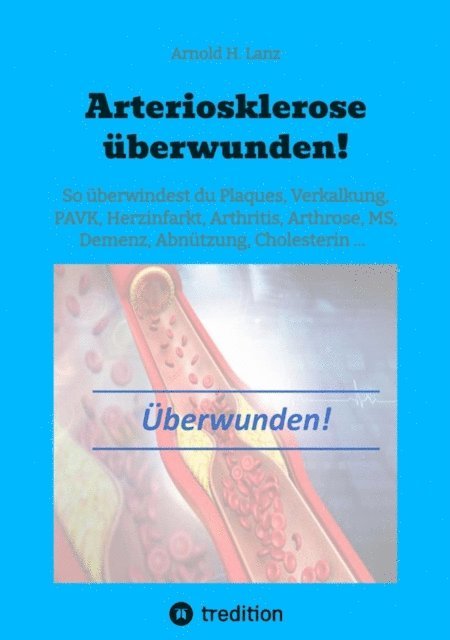 Arnold H. Lanz - Arteriosklerose überwunden!, E-bok. Tillgänglighet: Lägg i varukorg