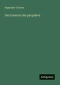 Des tumeurs des paupi�res