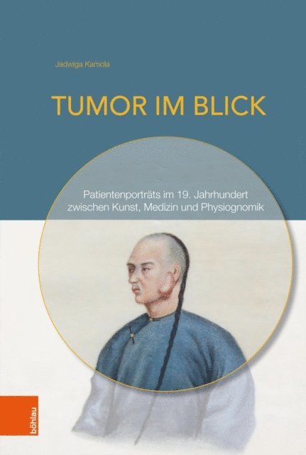 Jadwiga Kamola - Tumor im Blick, E-bok