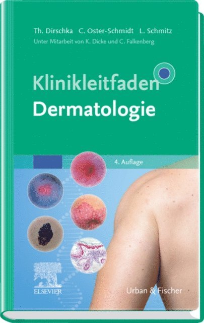Lutz Schmitz, Claus Oster-Schmidt, Thomas Dirschka - Klinikleitfaden Dermatologie, E-bok
