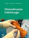 Minimalinvasive Fu?chirurgie