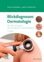 Maurice Moelleken, Joachim Dissemond - Blickdiagnosen Dermatologie, Häftad