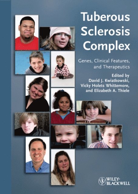 Elizabeth A. Thiele, Vicky Holets Whittemore, David J. Kwiatkowski - Tuberous Sclerosis Complex, E-bok
