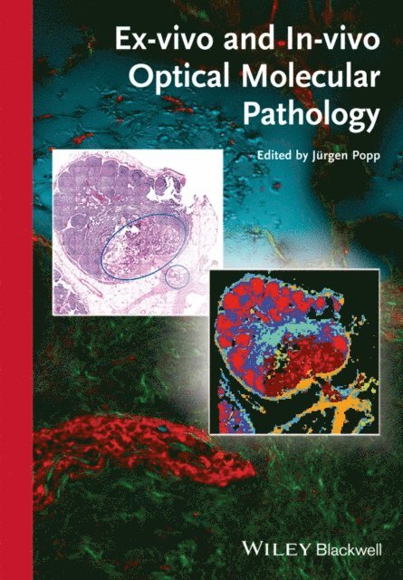 J rgen Popp - Ex-vivo and In-vivo Optical Molecular Pathology, E-bok