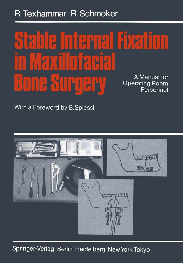 R. Texhammar, R. Schmoker - Stable Internal Fixation in Maxillofacial Bone Surgery, Häftad
