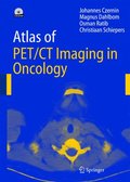 Atlas of Pet/Ct Imaging in Oncology: Atlas of PET