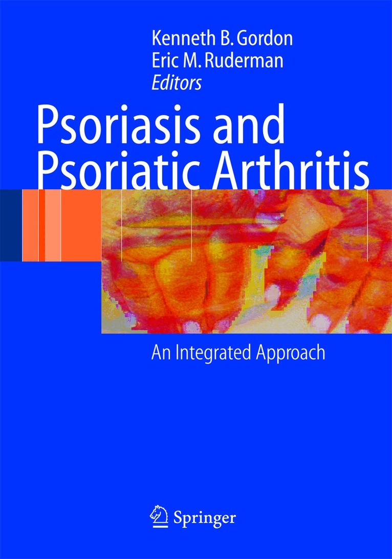 Kenneth B. Gordon, Eric M. Ruderman - Psoriasis and Psoriatic Arthritis, Inbunden. Tillgänglighet: Lägg i varukorg