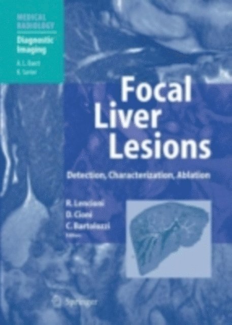 Carlo Bartolozzi, Dania Cioni, Riccardo Lencioni - Focal Liver Lesions, E-bok