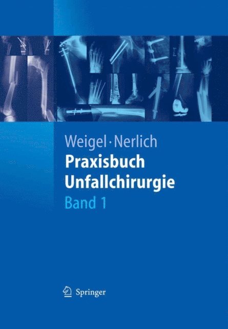Michael Nerlich, Bernhard Weigel - Praxisbuch Unfallchirurgie, E-bok