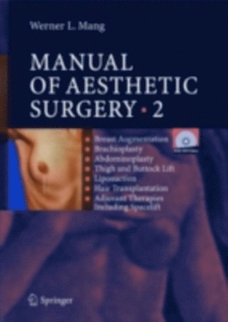 Werner Mang - Manual of Aesthetic Surgery 2, E-bok