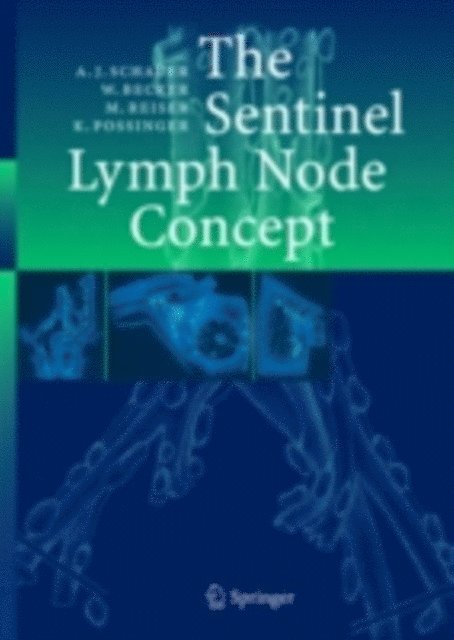 Kurt Possinger, Maximilian F Reiser, Wolfgang Becker, Alfred Schauer - Sentinel Lymph Node Concept, E-bok