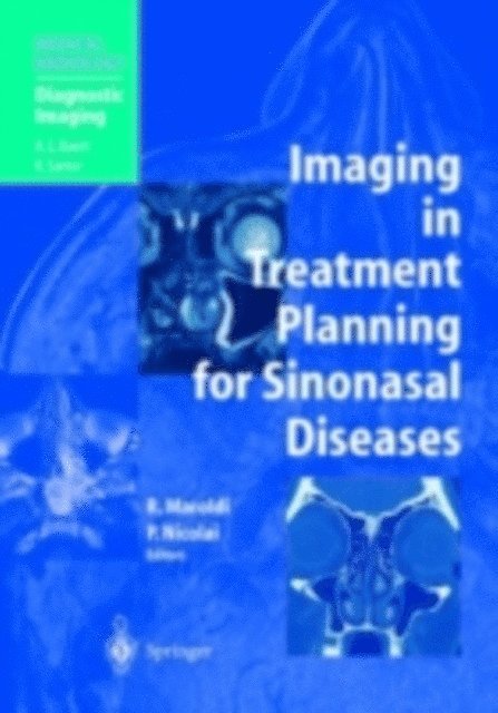 Piero Nicolai, Roberto Maroldi - Imaging in Treatment Planning for Sinonasal Diseases, E-bok