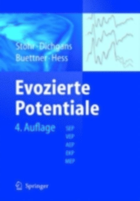 Christian W. Hess, Ulrich Buttner, Johannes Dichgans, Manfred Stohr - Evozierte Potenziale, E-bok