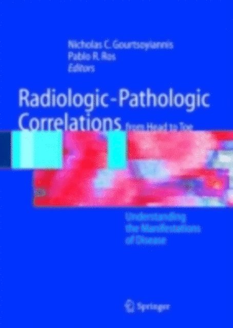 Pablo R. Ros, Nicholas C. Gourtsoyiannis - Radiologic-Pathologic Correlations from Head to Toe, E-bok