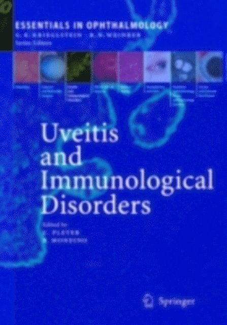 Bartly Mondino, Uwe Pleyer - Uveitis and Immunological Disorders, E-bok