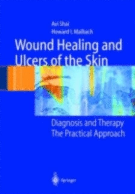 Howard I. Maibach, Avi Shai - Wound Healing and Ulcers of the Skin, E-bok