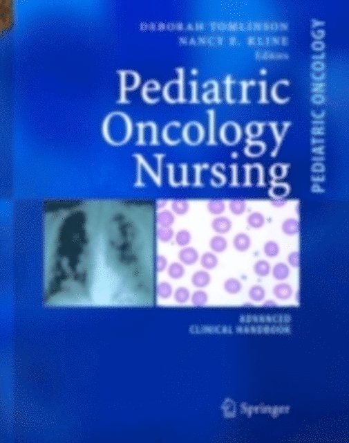 Nancy E. Kline, Deborah Tomlinson - Pediatric Oncology Nursing, E-bok