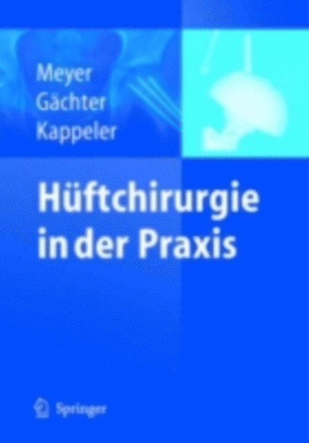 Urs Kappeler, Andre Gachter, Rainer-Peter Meyer - Hüftchirurgie in der Praxis, E-bok
