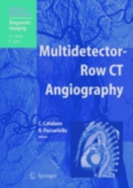 Roberto Passariello - Multidetector-Row CT Angiography, E-bok