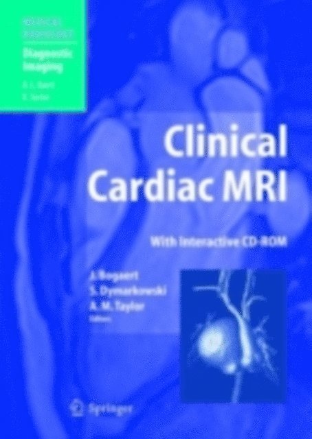 Andrew M. Taylor, Steven Dymarkowski, Jan Bogaert - Clinical Cardiac MRI, E-bok