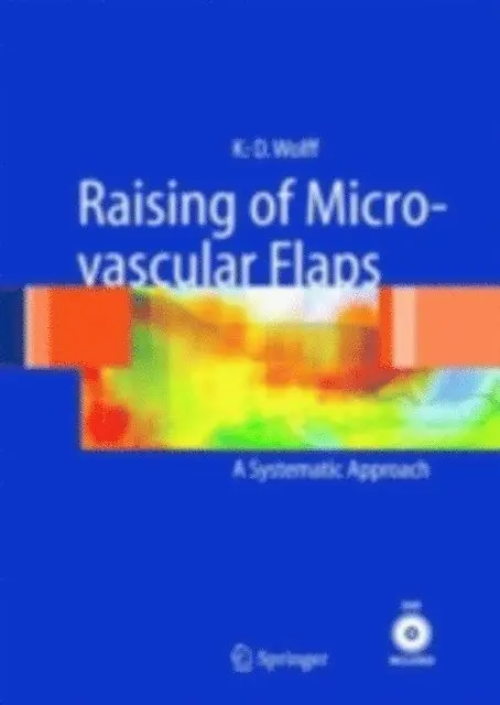 Frank Holzle, Klaus-Dietrich Wolff - Raising of Microvascular Flaps, E-bok. Tillgänglighet: Lägg i varukorg