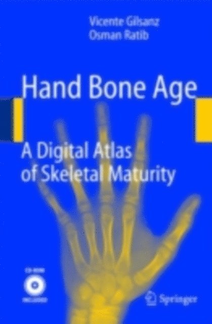 Osman Ratib, Vicente Gilsanz - Hand Bone Age, E-bok